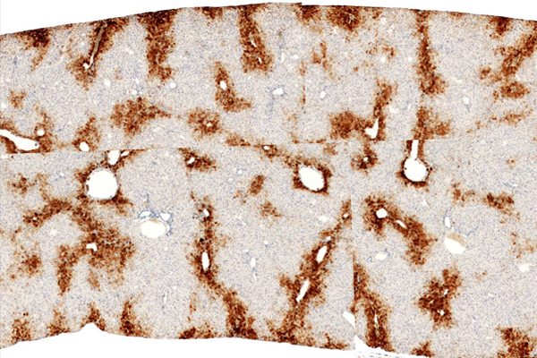 Glutamine Synthetase stain